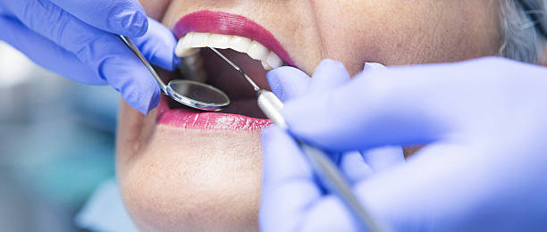 Best Pediatric Emergency Dentist in Stonegate, CO